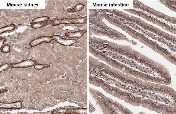 Immunohistochemistry-Paraffin SNX5 Antibody