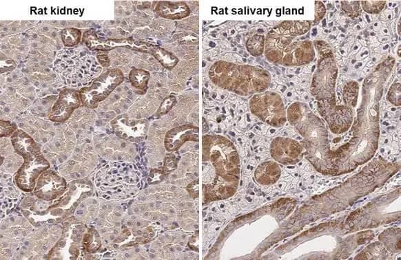 Immunohistochemistry-Paraffin: SNX5 Antibody [NBP2-20449] - SNX5 antibody [N2C2], Internal detects SNX5 protein by immunohistochemical analysis.Sample: Paraffin-embedded rat tissues.SNX5 stained by SNX5 antibody [N2C2], Internal (NBP2-20449) diluted at 1:500.Antigen Retrieval: Citrate buffer, pH 6.0, 15 min