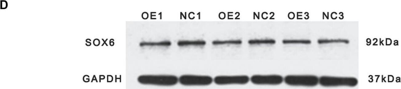 Validation of targeted binding relationship between miR-499-5p and target genes. (A) The relative expression levels of SOX6, PPP3CB, and FNIP1 in miR-499-5p overexpressing CPMs and negative control by qRT-PCR; (B) Results of luciferase reporter assay for SOX6 and miR-499-5p; miR-499-5p binding site mutant and wildtype vector of SOX6’s 3'UTR were used. (C) Results of the luciferase reporter as say for PPP3CB/miR-499-5p and FNIP1/miR-499-5p; only wildtype vectors were used. All results are shown as mean +/- SD. **p < 0.01 and *p < 0.05 as compared with control. (D) The protein levels of SOX6 in miR-499-5p overexpressing CPMs and negative control by western bolting. Image collected and cropped by CiteAb from the following open publication (//pubmed.ncbi.nlm.nih.gov/36186474), licensed under a CC-BY license. Not internally tested by Novus Biologicals.