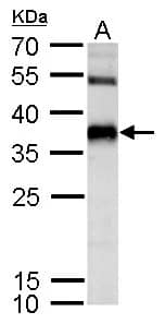 Western Blot: SPRY4 Antibody [NBP2-20479] - SPRY4 antibody detects SPRY4 protein by Western blot analysis.A. 30 ug NT2D1 whole cell lysate/extract12 % SDS-PAGESPRY4 antibody (NBP2-20479) dilution: 1:500