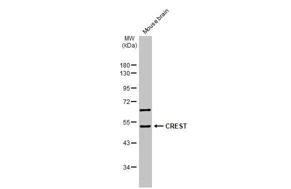 Western Blot SS18L1 Antibody - BSA Free