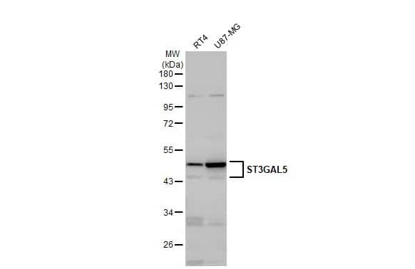 Western Blot: ST3GAL5 Antibody [NBP2-20492] - Various whole cell extracts (30 ug) were separated by 10% SDS-PAGE, and the membrane was blotted with ST3GAL5 antibody [N3C3] (NBP2-20492) diluted at 1:1000. The HRP-conjugated anti-rabbit IgG antibody  was used to detect the primary antibody.