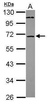 Western Blot ST6GALNAC1 Antibody