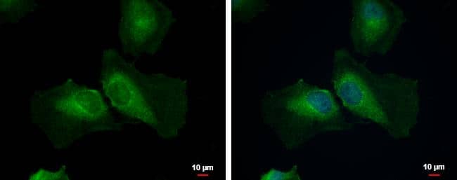 Immunocytochemistry/ Immunofluorescence AMSH-LP Antibody