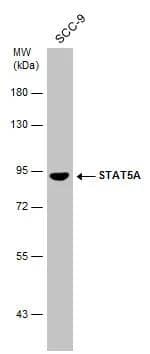 Whole cell extract (12.7 ug) was separated by 7.5% SDS-PAGE, and the membrane was blotted with STAT5A antibody [C2C3], C-term (NBP2-20505) diluted at 1:5000. 