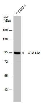 Whole cell extract (22.5 ug) was separated by 7.5% SDS-PAGE, and the membrane was blotted with STAT5A antibody [C2C3], C-term (NBP2-20505) diluted at 1:2000. 