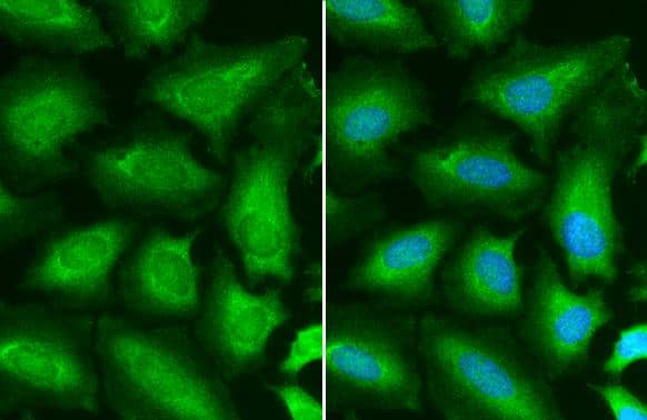 STAT6 antibody detects STAT6 protein at cytoplasm and nucleus by immunofluorescent analysis.Sample: HeLa cells were fixed in 4% paraformaldehyde at RT for 15 min.Green: STAT6 stained by STAT6 antibody (NBP2-20506) diluted at 1:500.Blue: Hoechst 33342 staining. 