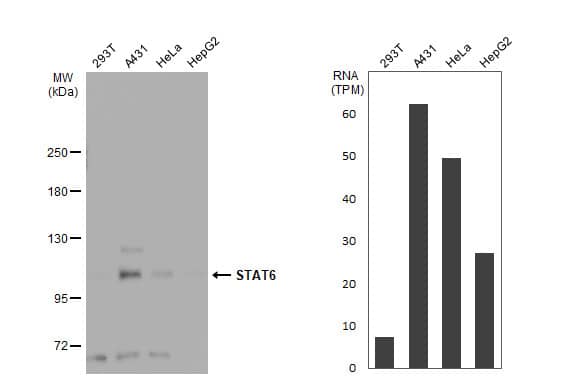 Various whole cell extracts (30 ug) were separated by 5% SDS-PAGE, and the membrane was blotted with STAT6 antibody (NBP2-20506) diluted at 1:1000. The HRP-conjugated anti-rabbit IgG antibody  was used to detect the primary antibody. Corresponding RNA expression data for the same cell lines are based on Human Protein Atlas program. 