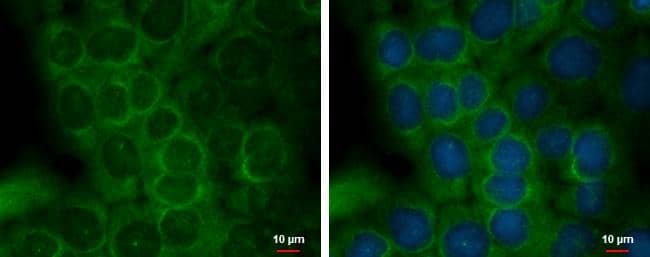 Immunocytochemistry/ Immunofluorescence Staufen Antibody - BSA Free
