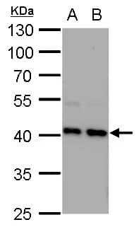 Western Blot: STRAP Antibody [NBP2-20521] - STRAP antibody [N1C3] detects STRAP protein by western blot analysis.A. 30 ug MCF-7 whole cell lysate/extractB. 30 ug MDA-MB-231 whole cell lysate/extract 10% SDS-PAGESTRAP antibody [N1C3] (NBP2-20521) dilution: 1:1000 The HRP-conjugated anti-rabbit IgG antibody  was used to detect the primary antibody.