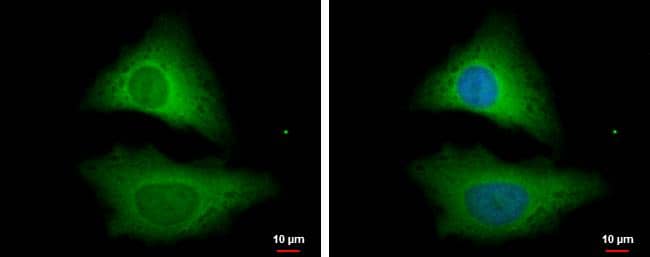 STRAP antibody [N1C3] detects STRAP protein at cytoplasm by immunofluorescent analysis.Sample: HeLa cells were fixed in 4% paraformaldehyde at RT for 15 min.Green: STRAP protein stained by STRAP antibody [N1C3] (NBP2-20521) diluted at 1:500.Blue: Hoechst 33342 staining. 