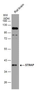 Rat tissue extract (50 ug) was separated by 10% SDS-PAGE, and the membrane was blotted with STRAP antibody [N1C3] (NBP2-20521) diluted at 1:1000. The HRP-conjugated anti-rabbit IgG antibody  was used to detect the primary antibody. 