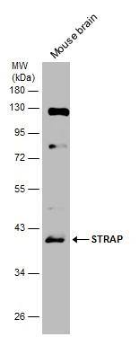 Mouse tissue extract (50 ug) was separated by 10% SDS-PAGE, and the membrane was blotted with STRAP antibody [N1C3] (NBP2-20521) diluted at 1:1000. The HRP-conjugated anti-rabbit IgG antibody  was used to detect the primary antibody. 