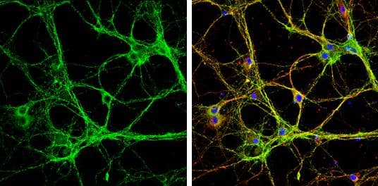 Munc18-1 antibody detects Munc18-1 protein by immunofluorescent analysis.Sample: DIV9 rat E18 primary cortical neurons were fixed in 4% paraformaldehyde at RT for 15 min.Green: Munc18-1 protein stained by Munc18-1 antibody (NBP2-20526) diluted at 1:500.Red: beta Tubulin 3/ Tuj1, stained by beta Tubulin 3/ Tuj1 antibody [GT886]  diluted at 1:500.Blue: Fluoroshield with DAPI . 
