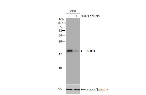 <b>Genetic Strategies Validation. </b>Non-transfected (-) and transfected (+) 293T whole cell extracts (30 ug) were separated by 15% SDS-PAGE, and the membrane was blotted with SOD1 antibody (NBP2-20534) diluted at 1:5000. The HRP-conjugated anti-rabbit IgG antibody  was used to detect the primary antibody. 