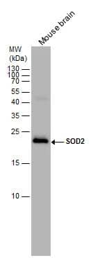 SOD2 antibody detects SOD2 protein by western blot analysis. Mouse tissue extracts (50 ug) was separated by 15% SDS-PAGE, and the membrane was blotted with SOD2 antibody (NBP2-20535) diluted by 1:1000. The HRP-conjugated anti-rabbit IgG antibody  was used to detect the primary antibody. 