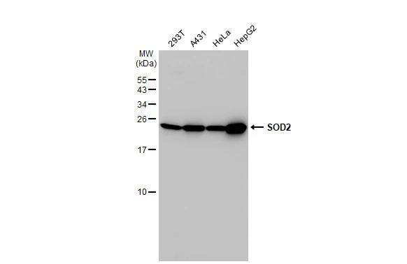 Various whole cell extracts (30 ug) were separated by 15% SDS-PAGE, and the membrane was blotted with SOD2 antibody (NBP2-20535) diluted at 1:1000. The HRP-conjugated anti-rabbit IgG antibody  was used to detect the primary antibody. 