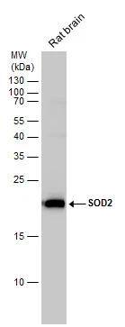 SOD2 antibody detects SOD2 protein by western blot analysis. Rat tissue extracts (50 ug) was separated by 15% SDS-PAGE, and the membrane was blotted with SOD2 antibody (NBP2-20535) diluted by 1:2500. The HRP-conjugated anti-rabbit IgG antibody  was used to detect the primary antibody. 