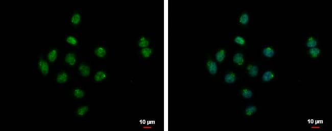 Immunocytochemistry/ Immunofluorescence SYAP1 Antibody - BSA Free