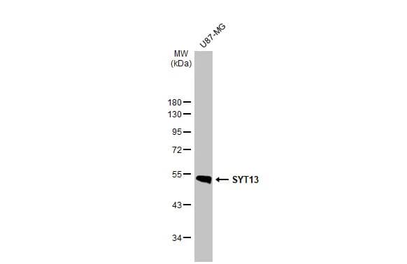 Western Blot: Synaptotagmin 13 Antibody [NBP2-20546] - Whole cell extract (30 ug) was separated by 10% SDS-PAGE, and the membrane was blotted with Synaptotagmin 13 antibody (NBP2-20546) diluted at 1:1000. The HRP-conjugated anti-rabbit IgG antibody  was used to detect the primary antibody.