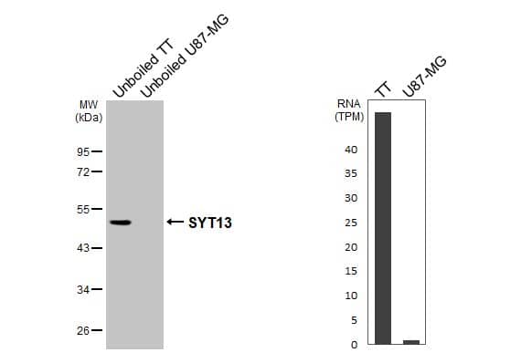 Various unboiled whole cell extracts (30 ug) were separated by 10% SDS-PAGE, and the membrane was blotted with SYT13 antibody (NBP2-20546) diluted at 1:1000. The HRP-conjugated anti-rabbit IgG antibody  was used to detect the primary antibody. 