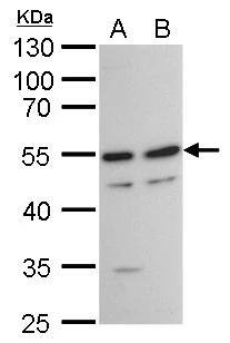 TAF7 antibody detects TAF7 protein by western blot analysis.A. 30 ug HeLa whole cell lysate/extractB. 30 ug HepG2 whole cell lysate/extract10 % SDS-PAGETAF7 antibody (NBP2-20556) dilution: 1:1000 