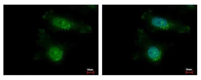 Immunocytochemistry/ Immunofluorescence TAO2 Antibody - BSA Free