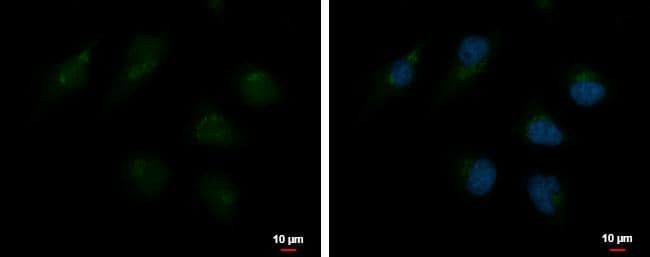 TMF1 antibody detects TMF1 protein at Golgi apparatus by immunofluorescent analysis.Sample: HeLa cells were fixed in 4% paraformaldehyde at RT for 15 min.Green: TMF1 protein stained by TMF1 antibody (NBP2-20572) diluted at 1:5000.Blue: Hoechst 33342 staining.Scale bar = 10 um. 