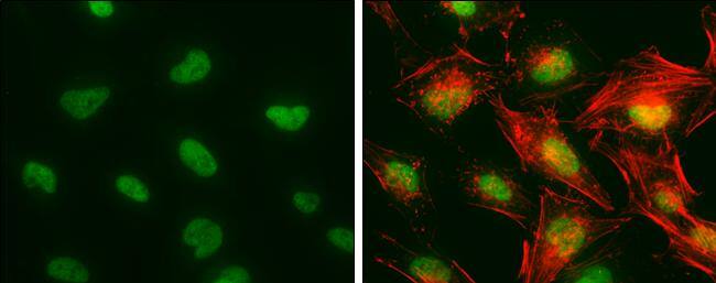 CA150 antibody detects CA150 protein at nucleus by immunofluorescent analysis.Sample: HeLa cells were fixed in 4% paraformaldehyde at RT for 15 min.Green: CA150 protein stained by CA150 antibody (NBP2-20584) diluted at 1:500.Red: phalloidin, a cytoskeleton marker, diluted at 1:50. 