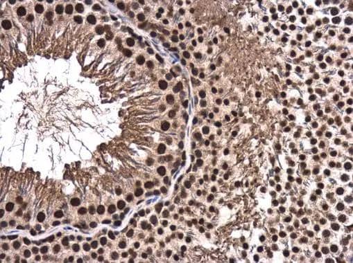 CA150 antibody detects CA150 protein at nucleus in rat testis by immunohistochemical analysis. Sample: Paraffin-embedded rat testis. CA150 antibody (NBP2-20584) diluted at 1:500. br>Antigen Retrieval: Citrate buffer, pH 6.0, 15 min 