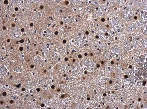 CA150 antibody detects CA150 protein at nucleus in mouse brain by immunohistochemical analysis. Sample: Paraffin-embedded mouse brain. CA150 antibody (NBP2-20584) diluted at 1:500. br>Antigen Retrieval: Citrate buffer, pH 6.0, 15 min 