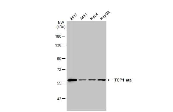 Various whole cell extracts (30 ug) were separated by 7.5% SDS-PAGE, and the membrane was blotted with TCP1 eta antibody [C1C3] (NBP2-20588) diluted at 1:1000. The HRP-conjugated anti-rabbit IgG antibody  was used to detect the primary antibody. 