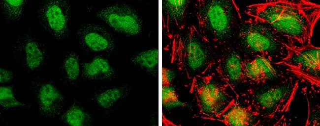 Immunocytochemistry/ Immunofluorescence: TET3 Antibody [NBP2-20602] - BMMSCs express Tet1, Tet2, & Tet3. a, b Both human (h) & mouse (m) BMMSCs expressed Tet1, Tet2, & Tet3, as assessed by western blotting (a) & qPCR (b). c Immunocytofluorescent staining showed that CD146-positive BMMSCs expressed Tet1, Tet2, & Tet3. Scale bar, 50 μm. Results are from three independent experiments. ***p Sample: HeLa cells were fixed in 4% paraformaldehyde at RT for 15 min.Green: TET3 protein stained by TET3 antibody [C3], C-term (NBP2-20602) diluted at 1:400.Red: phalloidin, a cytoskeleton marker, diluted at 1:50. 