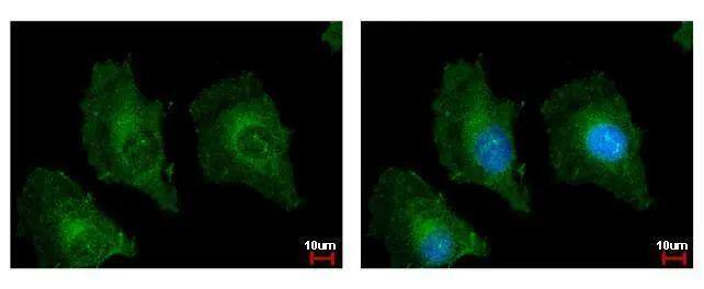 TSPAN3 antibody detects TSPAN3 protein at cytoplasm by immunofluorescent analysis. Sample: HeLa cells were fixed in ice-cold MeOH for 5 min.Green: TSPAN3 protein stained by TSPAN3 antibody (NBP2-20604) diluted at 1:500.Blue: Hoechst 33342 staining. 
