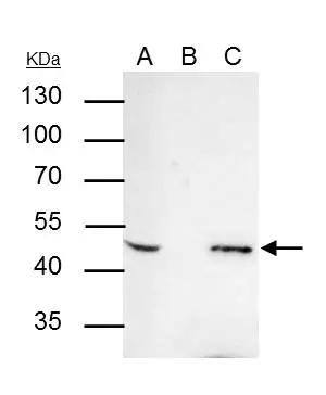 AP2 beta antibody immunoprecipitates AP2 beta protein in IP experiments.IP samples: MCF-7 whole cell extractA. 30 ug MCF-7 whole cell extractB. Control with 4 ug of preimmune Rabbit IgGC. Immunoprecipitation of AP2 beta protein by 4 ug AP2 beta antibody (NBP2-20606)7.5 % SDS-PAGEThe immunoprecipitated AP2 beta protein was detected by AP2 beta antibody (NBP2-20606) diluted at 1:1000.[EasyBlot anti-rabbit IgG  was used as a secondary reagent] 