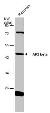 Rat tissue extract (50 ug) was separated by 10% SDS-PAGE, and the membrane was blotted with AP2 beta antibody (NBP2-20606) diluted at 1:500. 