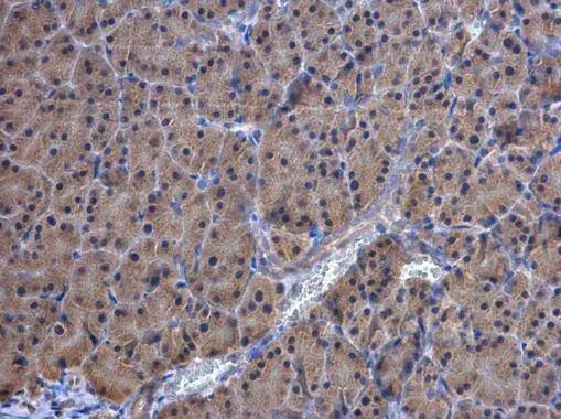 TrxR1 antibody [N3C2], Internal detects TrxR1 protein at cytoplasm and nucleus in mouse pancreas by immunohistochemical analysis. Sample: Paraffin-embedded mouse pancreas. TrxR1 antibody [N3C2], Internal (NBP2-20619) diluted at 1:500. br>Antigen Retrieval: Citrate buffer, pH 6.0, 15 min 