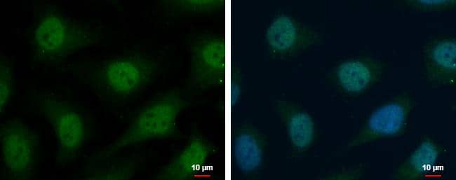 TrxR1 antibody detects TrxR1 protein at cytoplasm and nucleus by immunofluorescent analysis.Sample: HeLa cells were fixed in 4% paraformaldehyde at RT for 15 min.Green: TrxR1 protein stained by TrxR1 antibody (NBP2-20620) diluted at 1:500.Blue: Hoechst 33342 staining.Scale bar = 10 um. 