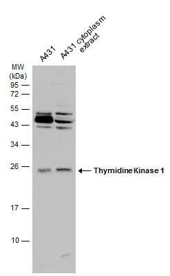 A431 whole cell and cytoplasm extracts (30 ug) were separated by 12% SDS-PAGE, and the membrane was blotted with Thymidine Kinase 1 antibody (NBP2-20626) diluted at 1:1000. 