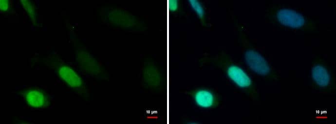 TDG antibody detects TDG protein at nucleus by immunofluorescent analysis.Sample: HeLa cells were fixed in 4% paraformaldehyde at RT for 15 min.Green: TDG protein stained by TDG antibody (NBP2-20627) diluted at 1:1000.Blue: Hoechst 33342 staining. 