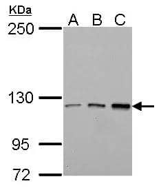 TIE1 antibody detects TIE1 protein by Western blot analysis.A. 30 ug Jurkat whole cell lysate/extractB. 30 ug Raji whole cell lysate/extractC. 30 ug K562 whole cell lysate/extract5 % SDS-PAGETIE1 antibody (NBP2-20635) dilution: 1:1000 