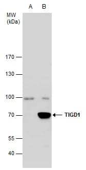 TIGD1 antibody detects TIGD1 protein by western blot analysis.A. 30 ug 293T whole cell extractB. 30 ug whole cell extract of human TIGD1-transfected 293T cells7.5 % SDS-PAGETIGD1 antibody (NBP2-20640) dilution: 1:5000 