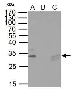 TIP30 antibody immunoprecipitates TIP30 protein in IP experiments. IP Sample: hela whole cell lysate/extract A. 40 ug hela whole cell lysate/extract B. Control with 2 ug of preimmune rabbit IgG C. Immunoprecipitation of TIP30 protein by 2 ug of TIP30 antibody (NBP2-20646) 10% SDS-PAGE The immunoprecipitated TIP30 protein was detected by TIP30 antibody (NBP2-20646) diluted at 1:1000. EasyBlot anti-rabbit IgG  was used as a secondary reagent 