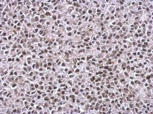 Immunohistochemistry TIP60 Antibody - BSA Free