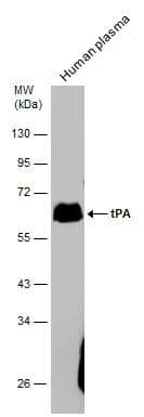 Western Blot t-Plasminogen Activator/tPA Antibody