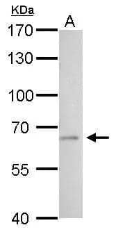 Western Blot t-Plasminogen Activator/tPA Antibody