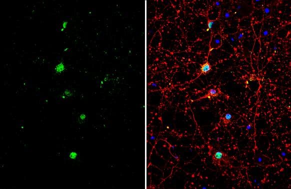 <b>Genetic Strategies Validation. </b>TLE1 antibody [N2C1], Internal detects TLE1 protein by immunofluorescent analysis.Sample: DIV10 rat E18 primary cortical neuron cells were fixed in 4% paraformaldehyde at RT for 15 min.Green: TLE1 stained by TLE1 antibody [N2C1], Internal (NBP2-20651) diluted at 1:500.Red: beta Tubulin 3/ Tuj1, stained by beta Tubulin 3/ Tuj1 antibody [GT11710]  diluted at 1:500.Blue: Fluoroshield with DAPI . 
