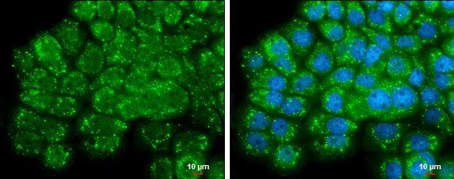 TMPRSS11D antibody detects secreted TMPRSS11D protein by immunofluorescent analysis.Sample: A431 cells were fixed in 4% paraformaldehyde at RT for 15 min.Green: TMPRSS11D protein stained by TMPRSS11D antibody (NBP2-20668) diluted at 1:500.Blue: Hoechst 33342 staining.Scale bar = 10 um. 