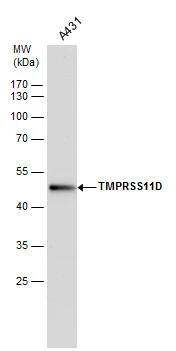TMPRSS11D antibody detects TMPRSS11D protein by western blot analysis. Whole cell extracts (30 ug) was separated by 10% SDS-PAGE, and the membrane was blotted with TMPRSS11D antibody (NBP2-20668) diluted by 1:500. 