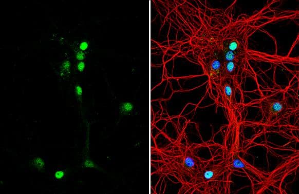 TNR antibody [C1C2], Internal detects TNR protein by immunofluorescent analysis.Sample: DIV9 rat E18 primary hippocampal neuron cells were fixed in 4% paraformaldehyde at RT for 15 min.Green: TNR stained by TNR antibody [C1C2], Internal (NBP2-20677) diluted at 1:500.Red: beta Tubulin 3/ Tuj1, stained by beta Tubulin 3/ Tuj1 antibody [GT11710]  diluted at 1:500.Blue: Fluoroshield with DAPI . 